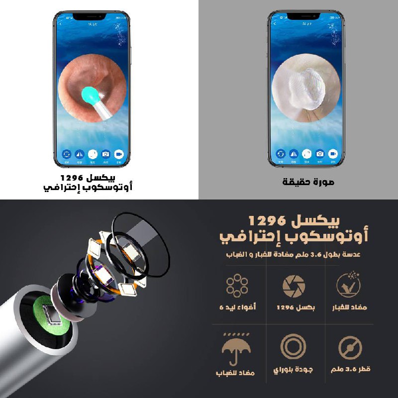 جهاز تنظيف الأذن الذكي من NE3 - 1SATOR.SHOP