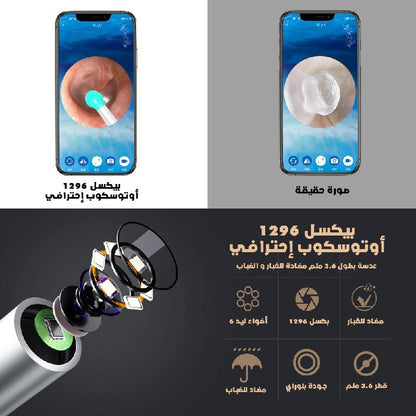 جهاز تنظيف الأذن الذكي من  NE3 - 1SATOR.SHOP